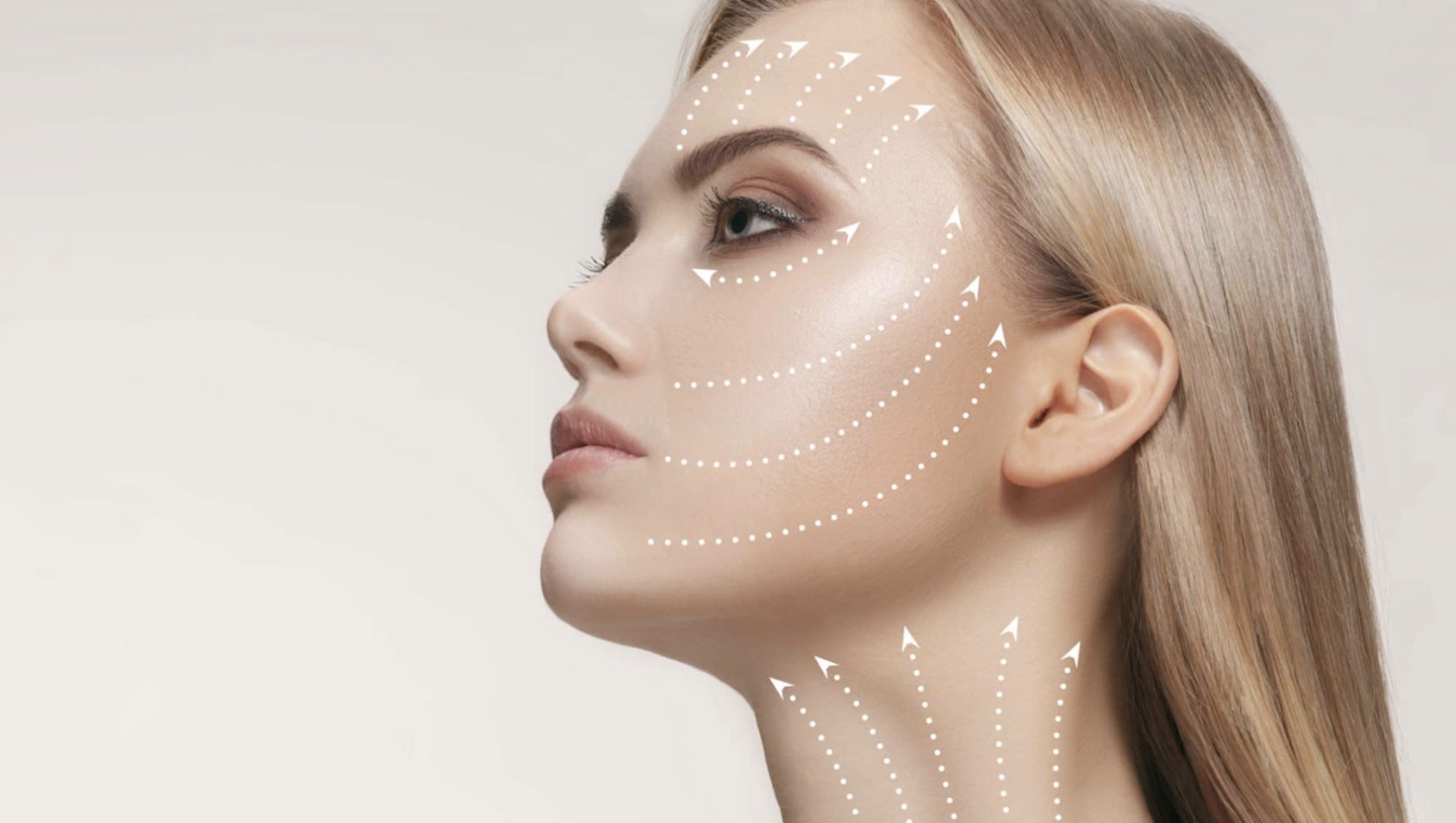 Тредлифтинг без операции: как достичь лифтинг-эффекта без скальпеля