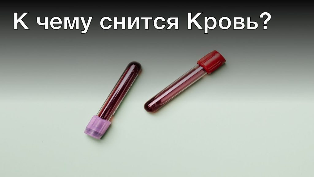 К Чему Снится Кровь: Толкование и Значение Сновидений